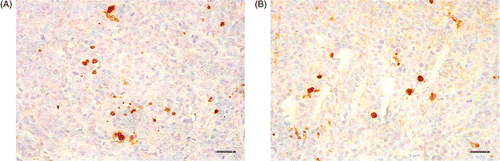 Figure 5. In situ apoptosis detection of tumor tissues at 48 h after treating with magnetic field. (A) injected with physiological saline; (B) injected with dextran magnetic fluid. The scale bars represent 50 µm.