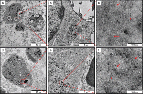 Figure 11.  TEM images of SWCNTs deposited in lungs of rats exposed to 2.0 mg/kg SWCNTs at 1 month (panels a–c) and 3 months (panels d–f) after instillation at different magnifications. At any of the time points, SWCNTs deposited in the lungs were typically phagocytosed by alveolar macrophages or macrophages in the interstitial tissues.