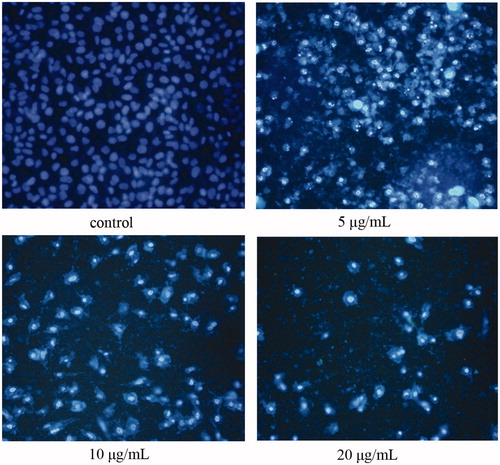 Figure 3. OA induces nueclear morphologic alterations of cells. After treatment with OA (5, 10, 20 μg/mL) for 24 h, cells were stained by Hoechst 33258. (A) Normal nuclei are symmetrical baby blue. (B)–(D) Fragmented nuclei displaying bright blue are presented in the advanced stage of apoptosis.