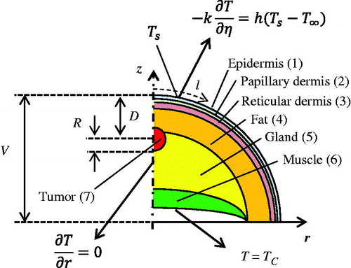 Figure 1. Schematic of the biophysical situation: breast cross section, tumour, tissue layers and the thermal boundary conditions.