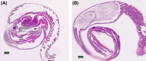 Figure 3. Histological evaluation: pathological changes in the large intestines of ApcMin mice; (A) a representative tumor found in an animal from the control group displaying features of an invasive adenoma protruding into intestinal lumen. Note: absence of Lieberkühn crypts around the adenoma. (B) a representative large intestine obtained from animal of treatment group showing completely unobstructed lumen and the absence of polyps; Original magnification: 4×. All tissues were stained with hematoxylin and eosin.