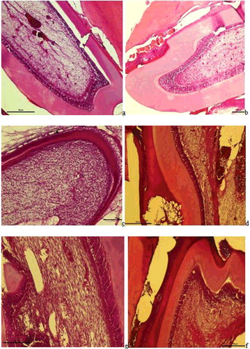 Figure 2. a– Group I: Dilatation and haemorrhage in the vessels of the pulp, an increase in collagen fibres, degeneration in odontoblast cells, and a widening of the periodontal membrane and alveolar spaces were observed (H-E staining Bar 100 µm); b – Group II: Haemorrhage in the small vessels of the pulp, hyperplasia and degeneration in odontoblastic cells and dilatation and haemorrhage in the vessels of the periodontal membrane were observed (H-E staining Bar 100 µm); c – Group III: Proliferation in the connective tissue cells in the pulp, regular alignment in collagen fibres and increased odontoblastic activity were observed (H-E staining Bar 100 µm); d -- Group V: Increased dilatation and haemorrhage in the vessls of the pulp, an increase in fibrous tissue and leukocyte infiltrations and loss of tissue with necrotic tissue and hyalinisation in the periodontal membrane were observed (H-E staining Bar 100 µm); e – Group VI: Dilatation in the pulp vessels and inflammatory cell infiltrations surrounding the vessel and degenerative changes in odontoblastic cells were observed (H-E staining Bar 50 µm); f -- Regular alignment was observed in the odontoblast cells at the border of the dentin and the pulp (arrow) and no change in the fibrous, vascular structure or cellular alignment in the pulp (H-E staining Bar 50 µm).