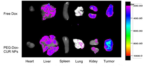 Figure 5 Representative ex vivo images of tumor and main organs (heart, liver, spleen, lung, and kidney) after administration of DOX and PEG-Dox-CUR NPs.Reprinted from Zhang Y, Yang C, Wang W, et al. Co-delivery of doxorubicin and  curcumin by pH-sensitive prodrug nanoparticle for combinationtherapy of cancer. Sci Rep. 2016;6(1):21225. This work is licensed under a Creative Commons Attribution 4.0 International License (http://creativecommons.org/licenses/by/4.0/). Citation55