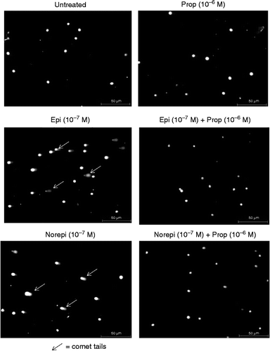 Figure 2.  Photographs of NIH 3T3 cells following comet assay. NIH 3T3 cells were untreated or treated (24 h) with stress hormones (epinephrine or norepinephrine) at 10− 7 M in the presence or absence of 10− 6 M propranolol. Arrows point to examples of comet tails. All pictures were taken at 50 × . Bars equal 50 μm. Epi, epinephrine; Norepi, norepinephrine; Prop, propranolol.