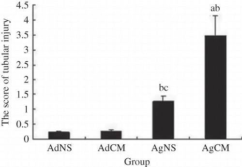 Figure 2.  The scores of tubular injury. AdNS, adult saline control group; AdCM, adult contrast media group; AgNS, aged saline control group; AgCM, aged contrast media group.Notes: ap < 0.01, compared with AgNS group.bp < 0.01, compared with AdCM group.cp < 0.01, compared with AdNS group.