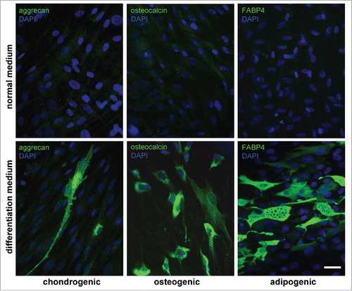 Figure 3. Abilities of AMC to differentiate into chondro-, osteo- and adipogenic directions. Immunofluorescence analysis of chondro- (aggrecan), osteo- (osteocalcin) and adipogenic (FABP4) markers under normal (upper panel) and differentiation inducting (lower panel) conditions, cell nuclei stained with DAPI (Bars 50 μm). Typical data of one of ten AMC cultures is presented; all ten tested AMC cultures were able to differentiate into three lineages.
