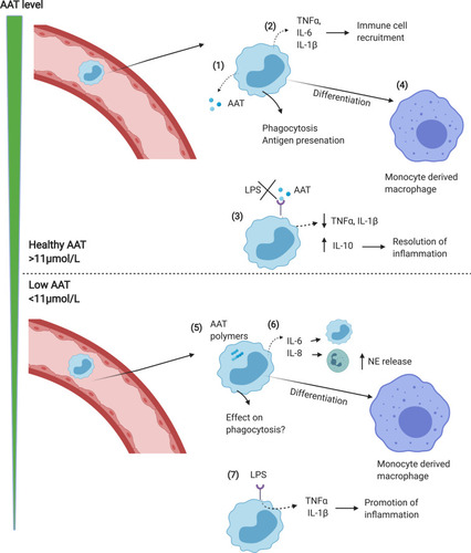Figure 1 Monocyte function in normal vs AATD lungs. (1) In response to infection/inflammation, circulating monocytes enter the lungs where they release AAT which acts to neutralise NE. (2) Monocytes also release cytokines including TNFα, CXCL-8, LTB4 and IL-6 to recruit immune cells including neutrophils and monocytes. (3) AAT blocks LPS induced pro-inflammatory cytokine release, thus limiting inflammation. (4) Monocytes differentiate into monocyte-derived macrophages, adding to the alveolar macrophage pool. (5) In AATD, AAT polymers form in monocytes, leading to elevated release of pro-inflammatory cytokines including IL-6 and CXCL-8 which increases neutrophil recruitment (6), thus increasing NE levels and activity in the lungs. (7) Levels of AAT below the putative protective threshold (<11μmol/L) causes LPS induced pro-inflammatory cytokine release to increase, driving inflammation.