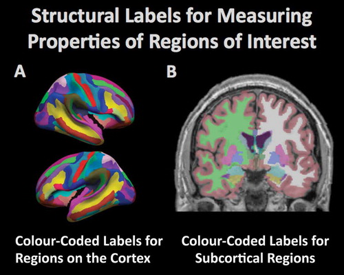 Figure 3. Computational procedures can be used to model the brain and to measure the structural properties of brain tissue within defined regions. The figure demonstrates the automated (A) parcellation of the cerebral cortex based on gyral anatomy and (B) segmentation of subcortical regions by the FreeSurfer software suite (freesurfer.net). The amount of tissue in the different regions is typically compared between groups to determine regional vulnerability to degenerative processes.