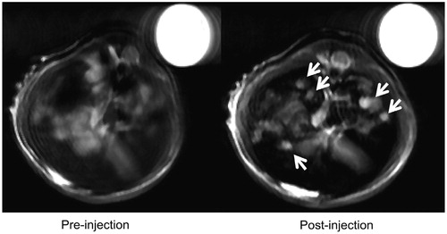 Figure 13. MRI images of mouse liver before and after injection of CNT-PDDA-SPIO@Lac-Gly (10 mg/kg) (white arrows indicate tumours) compared to internal standard (water, top right) [Citation124].