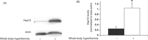 Figure 1. Changes in Hsp72 levels in pancreatic tissue after pretreatment with whole-body hyperthermia in rats. (A) Hsp72 expression in rat pancreatic tissue 48 h after WBH treatment at 42 °C or ambient temperature was detected by Western blot. (B) Signal intensities were based on densitometry using an image analyser. All data are expressed as the mean ± standard deviation (SD); * denotes a significant difference compared to the negative control group (p < 0.05).