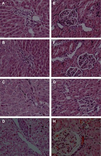 Figure 7 Effects of ZnO nanoparticles on the histopathologic appearance of liver and kidney tissues (HE ×400).Notes: Liver: control group (A), 100 mg/kg (B), 300 mg/kg (C), and 600 mg/kg (D). Kidney: control group (E), 100 mg/kg (F), 300 mg/kg (G), and 600 mg/kg (H). (C) Liver cells are slightly swollen (arrows). (D) The intercellular space shows evidence of minor hemorrhage (arrows). (H) The glomerular and renal tubular epithelial cells have severe hemorrhage (arrows). Microscopic abnormalities were found in the group fed with ZnO nanoparticles at dose 300 mg/kg (C and G) and more severe abnormalities in the group fed at dose 600 mg/kg (D and H).Abbreviations: ZnO, zinc oxide; HE, hematoxylin and eosin.