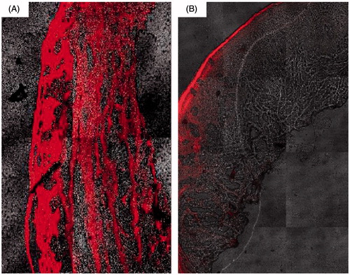 Figure 3. Confocal images of cross-sections of nasal mucosa after application of (A) rhodamine-loaded transfersomes (T14) and (B) rhodamine solution.