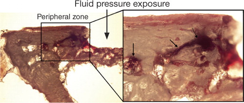 Figure 8. Titanium particles showing the fluid displacement during a pressure episode. Most of the titanium particles were found in cavities and canals within the bone at the peripheral zone around the pressurized area (right picture). The right picture shows titanium particles within pre-formed cavities in the peripheral zone of the bone. Arrows indicate titanium particles that were used as tracers the fluid displacement.