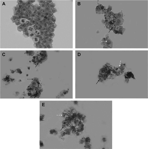 Figure 2.  Morphological features induced by neosergeolide. Microscopic analysis of untreated (A) and neosergeolide-treated HL-60 cells (C-0.05 µM, D-0.1 µM and E-0.2 µM). Doxorubicin (0.6 µM) was used as positive control (B). Cells were incubated for 24 h and stained by May-Grünwald-Giemsa. Black arrows: nuclei pyknotic and nuclear fragmentation, white dashed arrows: debris, and black dashed arrow: membrane damage. Magnification: 400×.