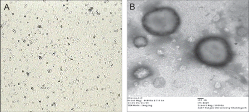 Figure 1.  Vesicles morphology of optimized oleic acid vesicles by (A) optical microscopy (400× magnification) and (B) TEM at 80 kV and 50,000×.