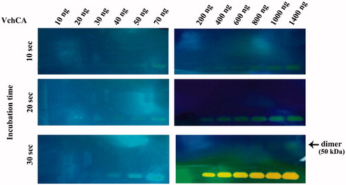 Figure 2. Protonogram obtained at different concentrations of VchCA. The yellow band corresponds to the VchCA position on the gel. Incubation times were 10, 20 and 30 s, higher than those indicated for bCA and shown in Figure 1.