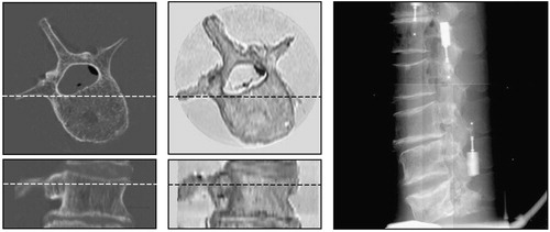 Figure 5. Transverse and sagittal views of CT (left) and MR (center) sub-volumes, and a lateral X-ray image (right).