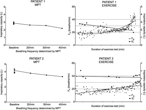 Figure 5.  Comparison between DH induced during MPT and XT for two separate patients. Patient 1 demonstrates DH during both MPT and XT; a respiratory rate above 40 breaths/min is achieved during XT. Patient 2 demonstrates DH during MPT but not during XT, which is terminated prematurely due to exhaustion; the highest respiratory frequency reached during XT is only approximately 30 breaths/minute.