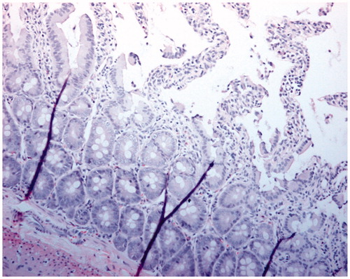 Figure. 4 Hematoxylin and eosin staining of intestine tissue sections (200×) of PolyHb reperfusion after 90 min ischemia and 1 h resuscitation.