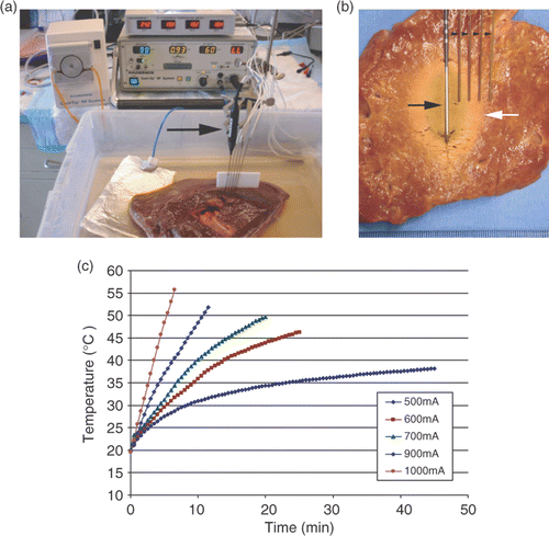 Figure 1. Overview of the experimental design. (a) An internally cooled 3 cm RF electrode (arrow) has been inserted into a sample of bovine liver placed in a 0.9% saline bath. The RF generator and a temperature measurement device can be seen in the background. Thermocouple probes (arrowheads) are placed at defined distances (5, 10, 15, and 20 mm diameter from the RF electrode (arrow), so the end temperature at the ablation margin can be registered. (b) In this case coagulation margin (white arrow) extends to the third thermocouple 15 mm from the electrode. Thermal dose represented as area under the curve for the relationship between temperature and time. (c) Representative temperature–time tracings for multiple currents are shown. With higher RF currents the rate of temperature increase was much higher than with lower currents.