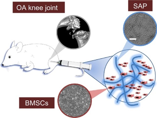 Figure 1 Bone marrow-derived mesenchymal stem cells (BMSCs) encapsulated in self-assembled peptide (SAP) were injected directly into the articular cavity of osteoarthritis (OA) knee joints. SAP is characterized by the formation of networks of peptide β-sheet filaments. Scale bar 50 nm.