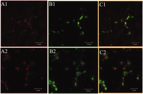 Figure 2. Confocal microscopic images of platelets incubated with TS liposomes (A1,B1,C1) and control liposomes (A2,B2,C2). A1 and A2 represent platelets incubated with rhodamine; B1 and B2 represent platelets incubated with FITC-labeled formulations and C1 and C2 are superimposed images of A and B.