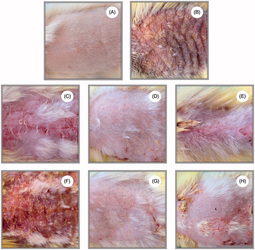 Figure 6. The morphological changes of different groups in rat dorsal skin. (A) healthy control, (B) atopy control, (C) BMV-loaded commercial cream, (D) BMV-loaded liposome in gel, (E) BMV-loaded nanoparticle in gel, (F) DFV-loaded commercial cream, (G) DFV-loaded liposome in gel, (H) DFV-loaded nanoparticle in gel.