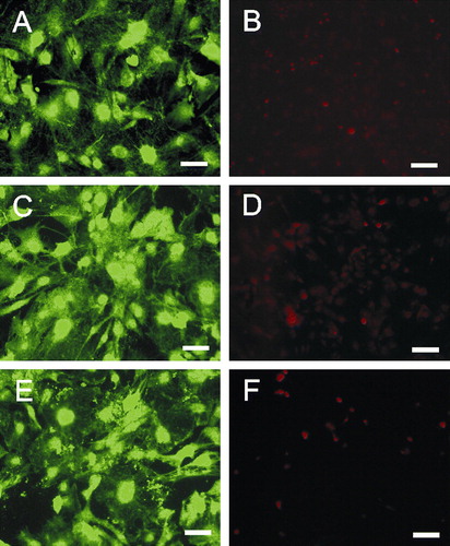 Figure 2.  Primary murine astrocytes after 72 h on poly-L-lysin coated glass slides (A, B), platinum (C, D) or gold (E, F) nanolawns. Astrocytes were stained intracellularly with CFSE (A, C and E) or propidium iodide (B, D and F) revealing uncompromised growth and negligible cell death on nano-lawns. Scale bars in A, C and E represent 50 µm; scale bars in B, D and F represent 100 µm. This Figure is reproduced in color in Molecular Membrane Biology online.