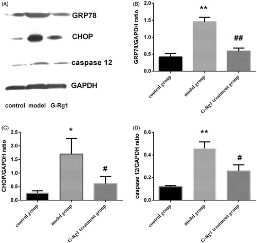 Figure 3. Effect of G-Rg1 on the expression of GRP78, CHOP and caspase 12 proteins in renal tissue. Expressions of GRP78 (78 kD), CHOP (27 kD), caspase 12 (42 kD) and GAPDH (36 kD) were determined by western blot. Respective images are shown in (A) and quantification of relative densitometries is shown in (B) (GRP78), (C) (CHOP), (D) (caspase 12), respectively. *p < 0.05, **p < 0.01 versus control group; #p < 0.05, ##p < 0.01 versus model group.