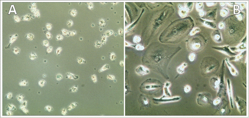 Figure 5. Exposure of PBMNCs to control HEK293-CM and recombinant CHI3L1. Incubation of normal PBMNCs with HEK-293 CM resulted in attachment of residual monocytes (A) in contrast to exposure with 2 ng/mL recombinant CHI3l1 which resulted in appearance of differentiated macrophages (B).