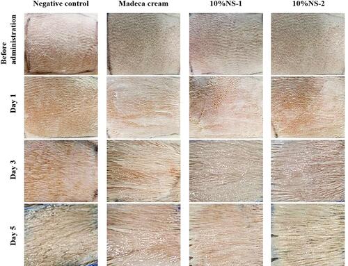 Figure 6 Representative images of dorsal skin of normal rats after daily application of CA-free vehicle, high-payload NSs (10%NS-1 or 10%NS-2), or marketed cream for 5 days.