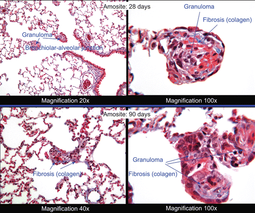 Figure 11.  Histopathological photomicrographs: microgranuloma observed in an amosite-exposed lung at 28 and 90 days postexposure. Left pane at lower magnification of 20× or 40×. Right pane at a magnification of 100× showing at 28 days collagen developing in the granuloma (blue color). The right pane at 90 days shows granuloma with collagen deposition sufficient to be characterized as interstitial fibrosis.
