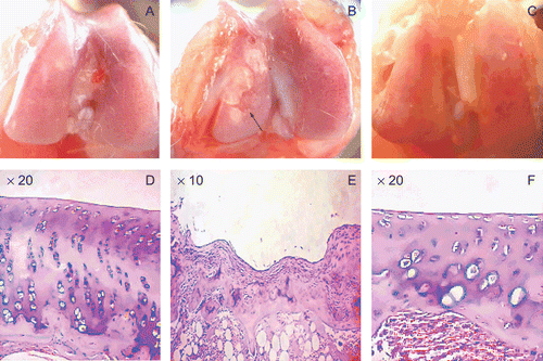 Figure 7.  The gross observation and the histomorphology of femoral condyle in knee joint. (A) and (D) are the control groups; (B) and (E) are the model groups, which demonstrated the severe ulcer (see the arrow) in femoral condyle. In this ulcer area, hyperplasia was seen in the synovium and the other cell layers were unclear. (C) and (F) are the ethanol extract (200 mg/kg) groups. There were no obvious differences when compared with the control groups, indicating regular surface and good arrangement of all cell layers. However, there was a little congestion in (C) and hypertrophy and a little shorter height in cartilage in (F).