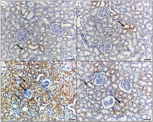 Figure 3. p65 immunohistochemical staining in the kidney of mice in the different groups. A) Control group and B) Mice treated by gallic acid alone showing minimal p65 reactivity in few cells for proximal tubules (arrow). C) Mice treated by NiO-NPs only showing high p65 immunoreactivity in podocytes, proximal and distal tubules cells (arrows). D) Mice treated by NiO-NPs and gallic acid showing minimal p65 immunoreactivity in the proximal tubules cells (arrows). Original magnification 200X, scale bar 50 µm.
