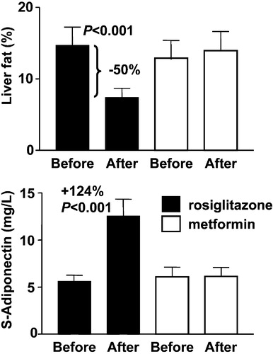 Figure 7 Effects of 4 months of rosiglitazone or metformin treatment on percent liver fat (upper panel) and serum adiponectin concentrations (lower panel) in type 2 diabetic patients. Reproduced with permission from Citation37.