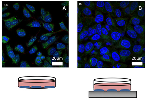 Figure 7 Representative confocal images of (A) nano-Fe3O4-coated with CUR on SKOV-3, and (B) nano-Fe3O4-coated with CUR on SKOV-3 enhanced by magnetic field (Blue cells nuclei are labeled with DAPI, green nano-Fe3O4 are labeled with FITC (DXS-FITC), and red actin filaments are labeled with phalloidin-TRITC).
