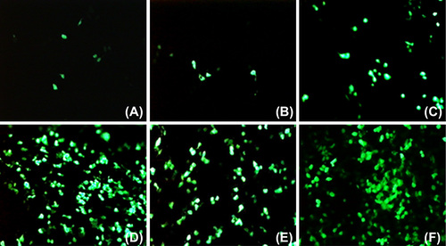 Figure 4. The effects of helper molecules on the transfection of pDNA with archaeosomes. HEK293 cells grown in 24-well plate were used in the experiments. Each well contains 1 μg pEGFP-N1 plasmid DNA diluted in the concentration of 25 ng/μl in DMEM (-), archaeosomes made of polar lipids of H. hispanica 2TK2 (10 μl) and helper molecules. (A) Archaeosome:pDNA (10 μl: 1 μg). (B) 20 mM CaCl2 (C) 50 mM CaCl2 (D) 100 mM CaCl2 (E) pDNA:DOTAP (1 μg: 10 μl) F) Archaeosome:pDNA:DOTAP (10 μl: 1 μg: 10 μl).
