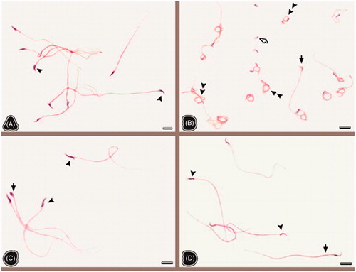 Figure 1. The sperm smears belonging to non-obese control (A), obese control (B), non-obese thymoquinone (C), and obese thymoquinone (D) groups are shown. Arrowheads: normal sperm morphology; double arrowheads: Dag effect; white filled arrow: tail-less sperm; black arrow: sperms with head and tail anomaly. The general morphology of sperms is seen in the all groups. Tail-less sperms, sperms with head and tail anomalies and also Dag effect are seen in the sperm smears of the OC group. But following TQ application, sperms having normal morphology are seen in the sperm smears of the OT group. Dye: HE; Scale Bars: 25 µm.