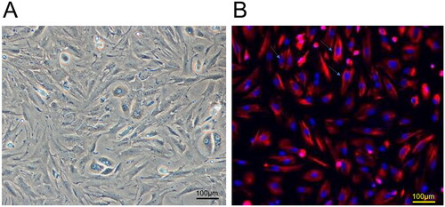 Figure 3. Decidual cell matrix of primary culture in early human pregnancy. A: Decidual stromal cells isolated under a light microscope. B: Identification of decidual stromal cells by immunofluorescence. The red fluorescent ones are metaphase interstitial cells.