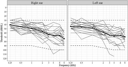 Figure 1. Audiograms for the right and left ears of participants (thin lines). Bold lines show the average hearing thresholds. Dashed lines indicate the fitting range of the test devices.