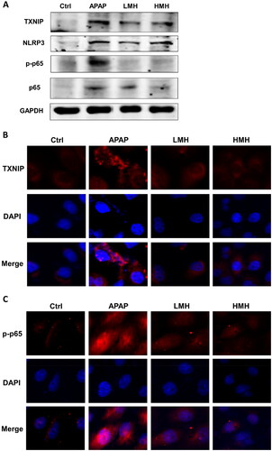 Figure 4. MgH2 suppresses APAP-induced TXNIP/NLRP3/NF-κB signaling pathway activation in HK-2 cells.(A) The protein expressions of TXNIP, NLRP3, NF-κB p65 and p-NF-κB p65 in HK-2 cells were detected by western blotting.(B, C) The protein expressions of TXNIP and p-NF-κB p65 in HK-2 cells were detected with immunofluorescence assay.
