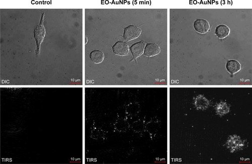Figure 4 Uptake of EO-AuNPs by RAW 264.7 cells observed with an enhanced dark-field (EDF) microscopy. Cells were incubated with EO-AuNPs (80 µg/mL) for 5 minutes and 3 hours and then were observed by EDF illumination system. The bright white spots inside the macrophages represent the aggregation of EO-AuNPs.Abbreviations: DIC, differential interference contrast; TIRS, thermal infrared sensor; EO-AuNPs, Euphrasia officinalis-gold nanoparticles.