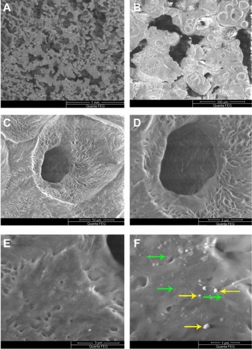 Figure 1 Scanning electron microscopy images of PCL-RNP. (A) PCL-RNP showing pores in the range of 50–100 μm. (B–D) Further magnification into the scaffold. (E and F) Nanoparticles and agglomerates embedded on the surface of the scaffold.Note: Green and yellow arrows show embedded nanoparticles and agglomerations, respectively.Abbreviations: PCL, polycaprolactone; RNP, resveratrol-loaded albumin nanoparticles.
