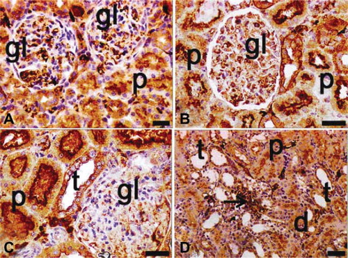 FIGURE 9. Immunohistochemical staining of NF-κ B (p65) in tissue sections of ovariectomy–diabetes and sepsis group (A–D). gl, glomerulus; d, distal tubules; p, proximal tubules; t, collecting tubules; arrows indicate extramesangial cells with p65 positive nuclei and cytoplasm; positivity was seen in especially cytoplasmic pattern of tubular cells, both cytoplasmic and nuclear pattern of extramesangial cells and commonly in glomeruli. The highest expression of p65 was found in this group among the all groups; magnification bars: 30 μm.