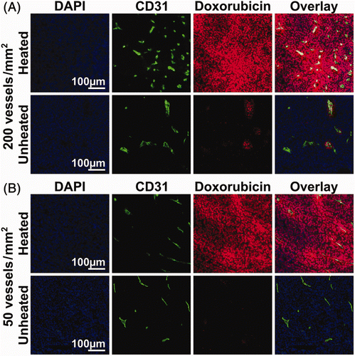 Figure 5. Heterogeneity of microregional distribution of doxorubicin in regions with varying tumour vascularity. Representative 0.5 mm × 0.5 mm regions of composite images from heated and unheated tumours showing doxorubicin fluorescence (red), DAPI staining (blue), and CD31 staining of vessel endothelial cells (green) from areas where vessel density was relatively high (A) and low (B). The number of vessels per mm2 was measured by counting distinct regions of CD31-stained endothelial cells.