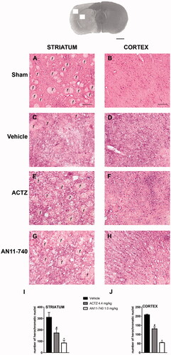 Figure 5. Effect of sub-chronic treatment with ACTZ and AN11-740 on the cytoarchitecture of the striatum and cortex 24 h after pMCAo. Upper part: Representative photomicrograph of a coronal section (at Bregma = 0Citation36,) showing the ischaemic area in a vehicle-treated rat. The two white squares indicate regions within the ischaemic area where photomicrographs were captured. Scale bar = 2 mm. (A–H) Representative microphotographs of H&E staining from dorsal striatum and fronto-parietal cortex of a sham-operated (A,B), a vehicle- (C,D), an ACTZ- (E,F) and an AN11-740-treated rat (G, H). The white matter fascicula (f) are evidenced. Scale bar = 100 µm. (I,J) Quantitative analyses of heterochromatic nuclei per striatal (I) and cortical areas (F) at coronal level AP = 0 from Bregma. Data represent the mean ± SEM of 3 rats/group. One-way ANOVA followed by Newman-Keuls post hoc test: #at least p < 0.05 ACTZ- vs. vehicle-treated rats; *at least p < 0.001 AN11-740- vs. vehicle-treated rats.
