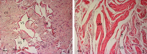 Figure 1. Hematoxylin and eosin staining of penile tissue from young rat (1) and human (2). Cavernous tissue has a sponge-like structure, with cavernous vascular spaces (VS) lined by endothelium (arrow) and separated by trabeculae composed mainly of connective tissue (CT), while smooth muscle fibers (SM) in the rat are restricted to endothelium periphery, in the human tissue organize in long contractile fibers distributed within trabeculae.
