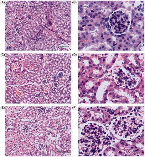 Figure 2. Effect of NML on renal morphological change in mice (HE staining). Note: A–B: Sham group; C–D: lipopolysaccharide (LPS) group; E–F: LPS + NML group.