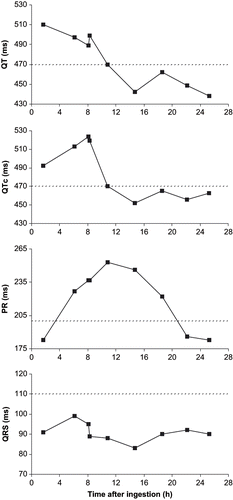 Fig. 2.  Electrocardiographic intervals after acute trazodone overdose. Broken line indicates upper limit of the normal reference range; QTc represents QT interval corrected for heart rate by Bazett's formula.