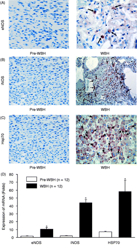 Figure 3. Immunohistochemical stain of eNOS (A), iNOS (B) and Hsp70 (C) in pre-WBH and WBH groups. The illustrative micrographs show changes in eNOS, iNOS and Hsp70 activities (arrows) after whole body hyperthermia. The enhancement was 3.1 ± 0.9-fold for eNOS, 10.6 ± 2.6-fold for iNOS, and 6.5 ± 1.4-fold for Hsp70 (*p < 0.05) (D).